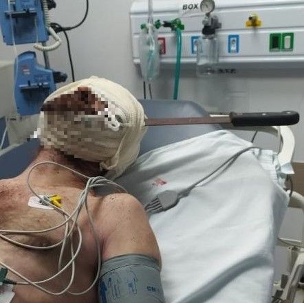 Suspeito de cravar facão na cabeça de homem é preso em SC