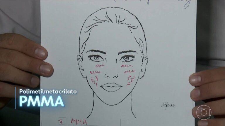 Influencer que perdeu lábio por uso de PMMA mostra rosto após cirurgias de reconstrução: ‘Já comprei um batom vermelho’ | Santa Catarina